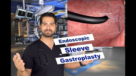 Is Endoscopic Sleeve Gastroplasty Covered by Insurance? Exploring Coverage Options for the Revolutionary Weight Loss Procedure.